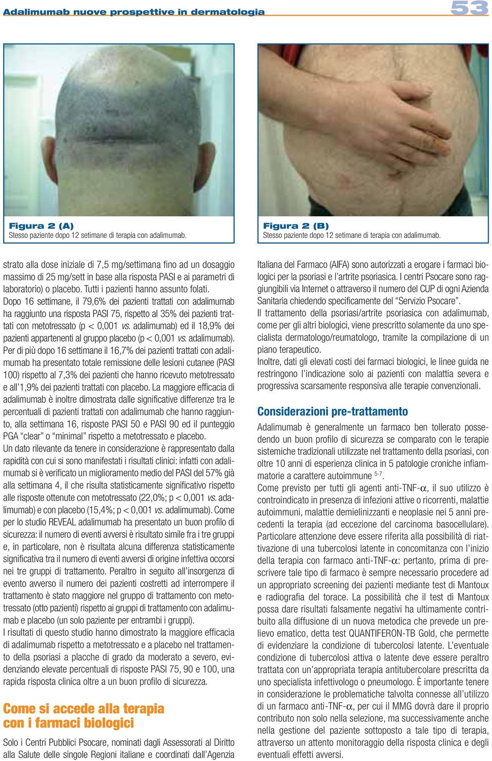 Dopo 16 settimane, il 79,6% dei pazienti trattati con adalimumab ha raggiunto una risposta PASI 75, rispetto al 35% dei pazienti trattati con metotressato (p < 0,001 vs.