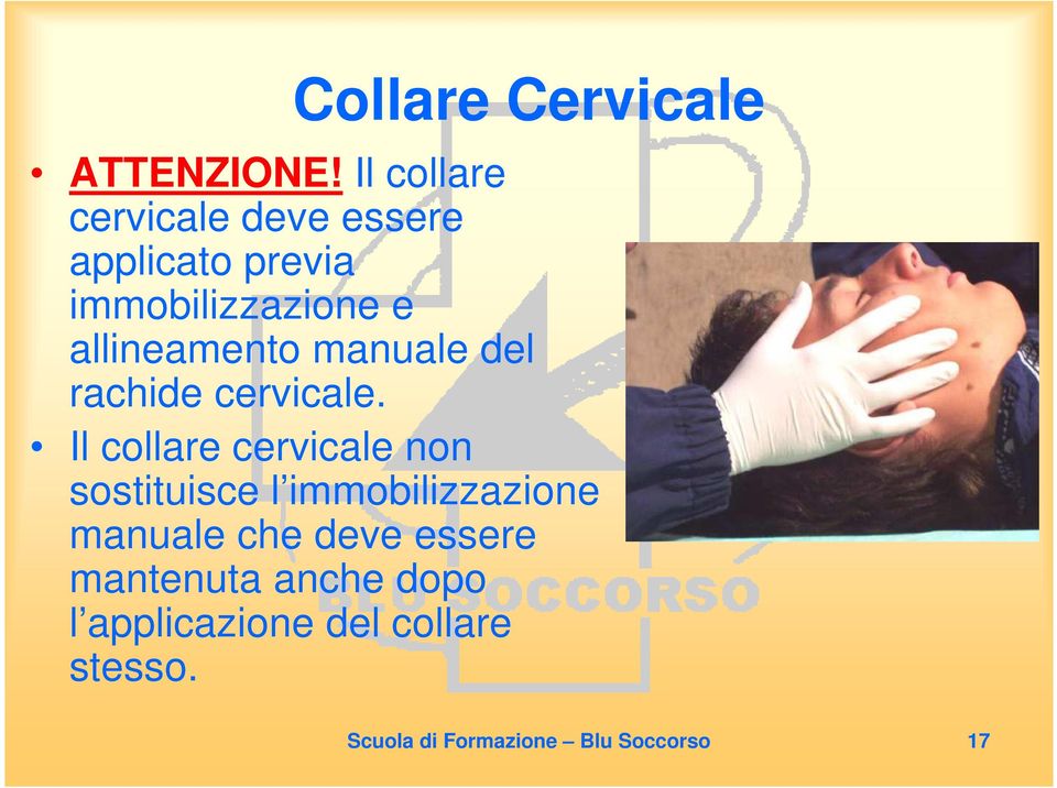 allineamento manuale del rachide cervicale.