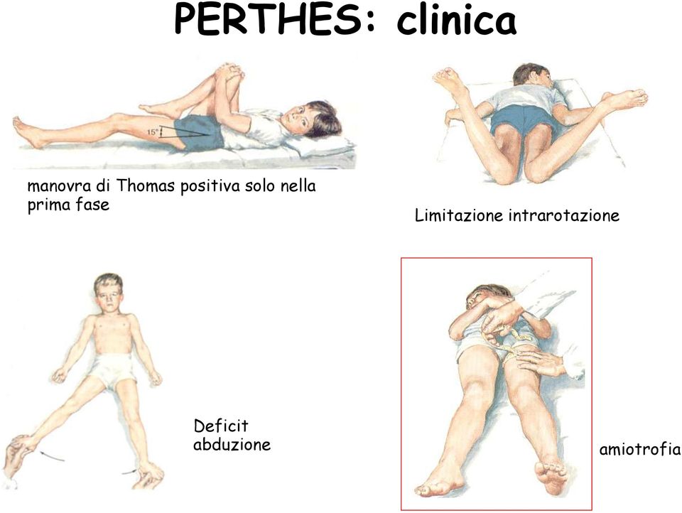 prima fase Limitazione