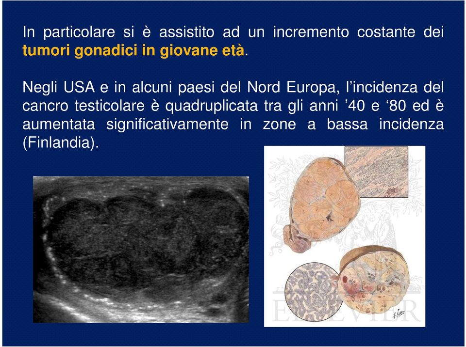 Negli USA e in alcuni paesi del Nord Europa, l incidenza del cancro