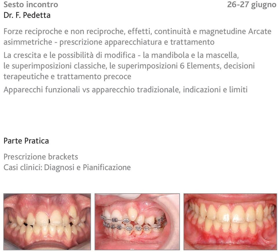 apparecchiatura e trattamento La crescita e le possibilità di modifica - la mandibola e la mascella, le superimposizioni