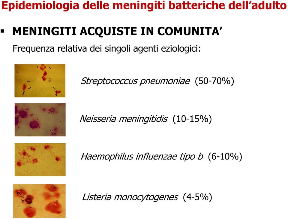 eziologici: Streptococcus pneumoniae (50-70%) Neisseria