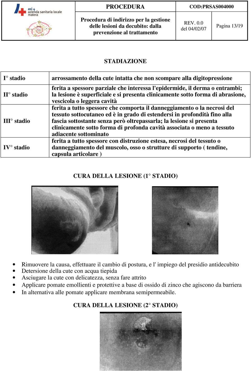 sottocutaneo ed è in grado di estendersi in profondità fino alla fascia sottostante senza però oltrepassarla; la lesione si presenta clinicamente sotto forma di profonda cavità associata o meno a