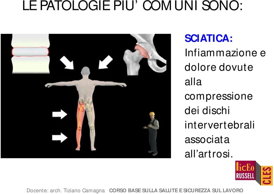 dovute alla compressione dei