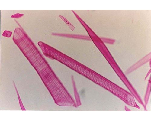 interna. Per osservare le singole fibre (cellule) nei preparati microscopici occorre separare le cellule l una dall altra. Ciò può avvenire realizzando un preparato per macerazione (figura 3).