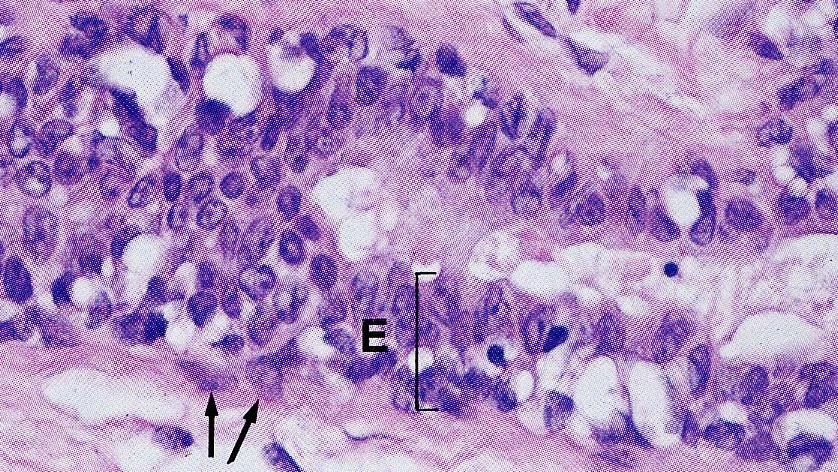 Ghiandola Mammaria Epiteliali cubiche o colonnari basse luminali Cellule