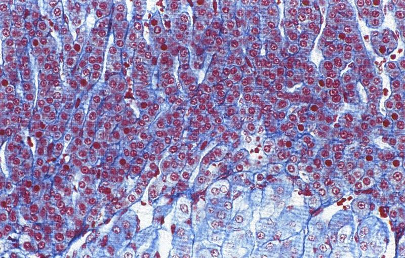 Cordoni di cellule che formano una rete Meno lipidi che nella fascicolata, più colore Mitocondri allungati con meno