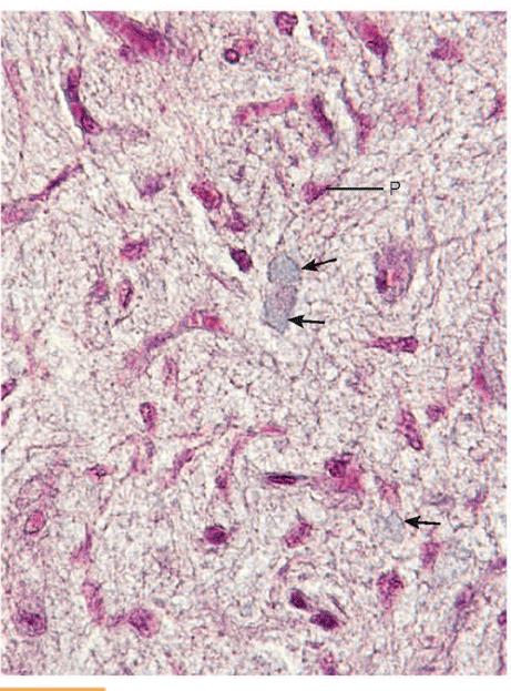 Ipofisi Posteriore Assoni senza mielina delle cellule neurosecretorie Ossitocina/vasopressina Corpi cellulari sono nell