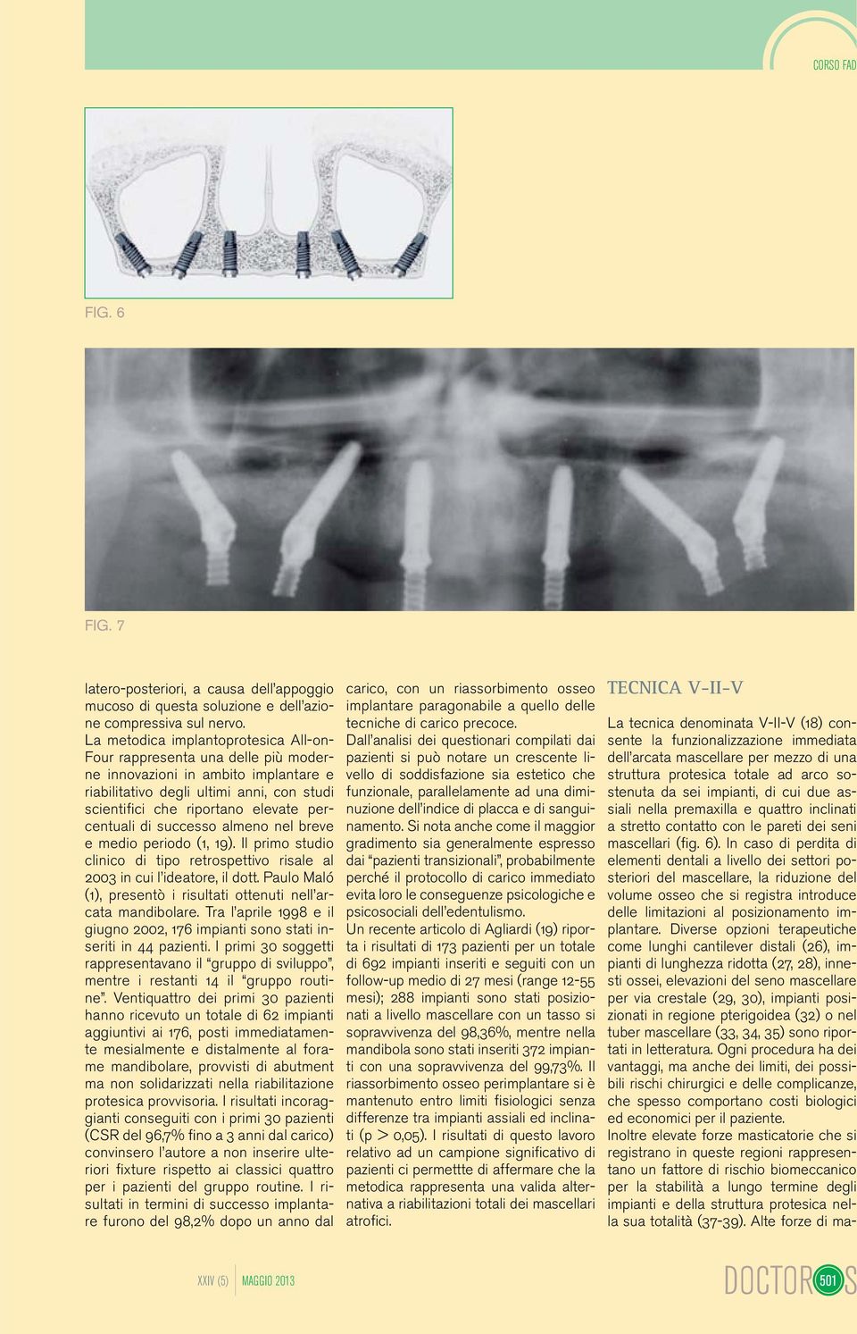 percentuali di successo almeno nel breve e medio periodo (1, 19). Il primo studio clinico di tipo retrospettivo risale al 2003 in cui l ideatore, il dott.