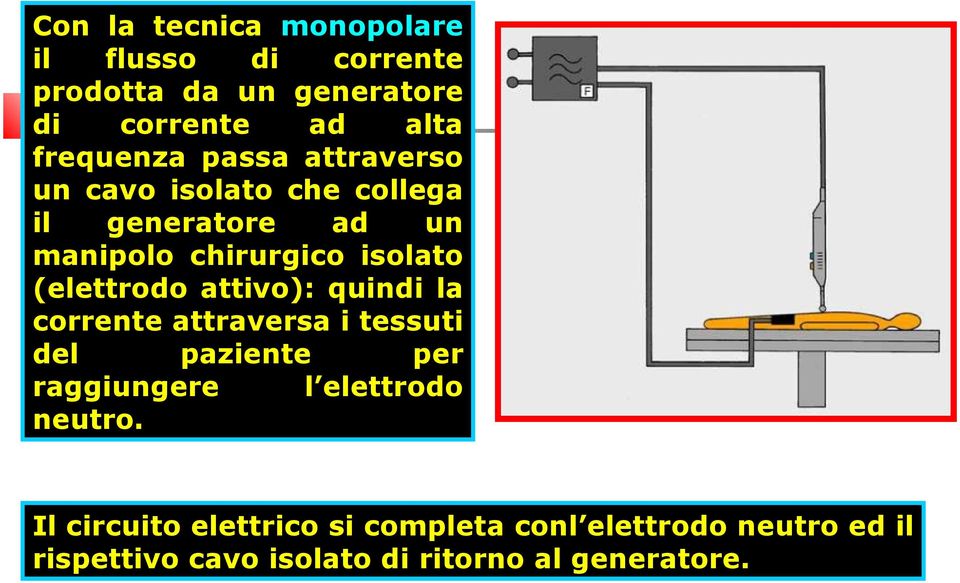 attivo): quindi la corrente attraversa i tessuti del paziente per raggiungere l elettrodo neutro.