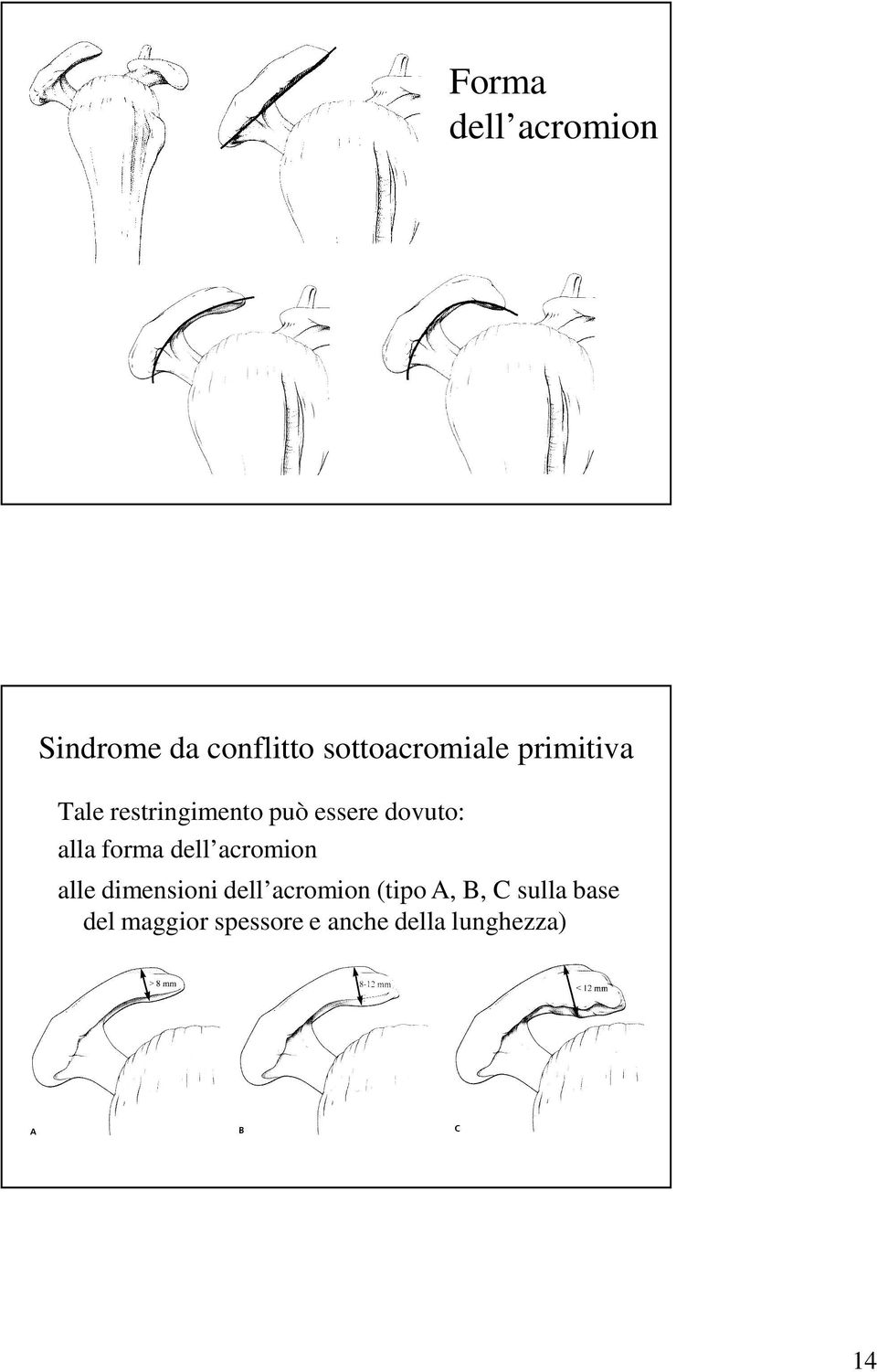 forma dell acromion alle dimensioni dell acromion (tipo A,