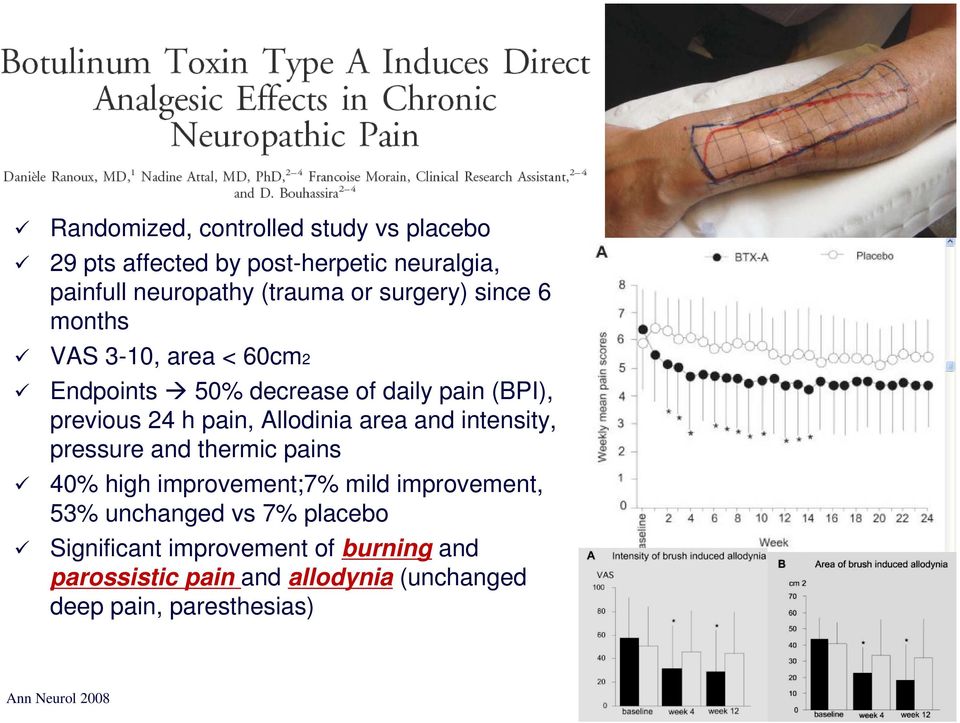 Allodinia area and intensity, pressure and thermic pains 40% high improvement;7% mild improvement, 53% unchanged vs 7%