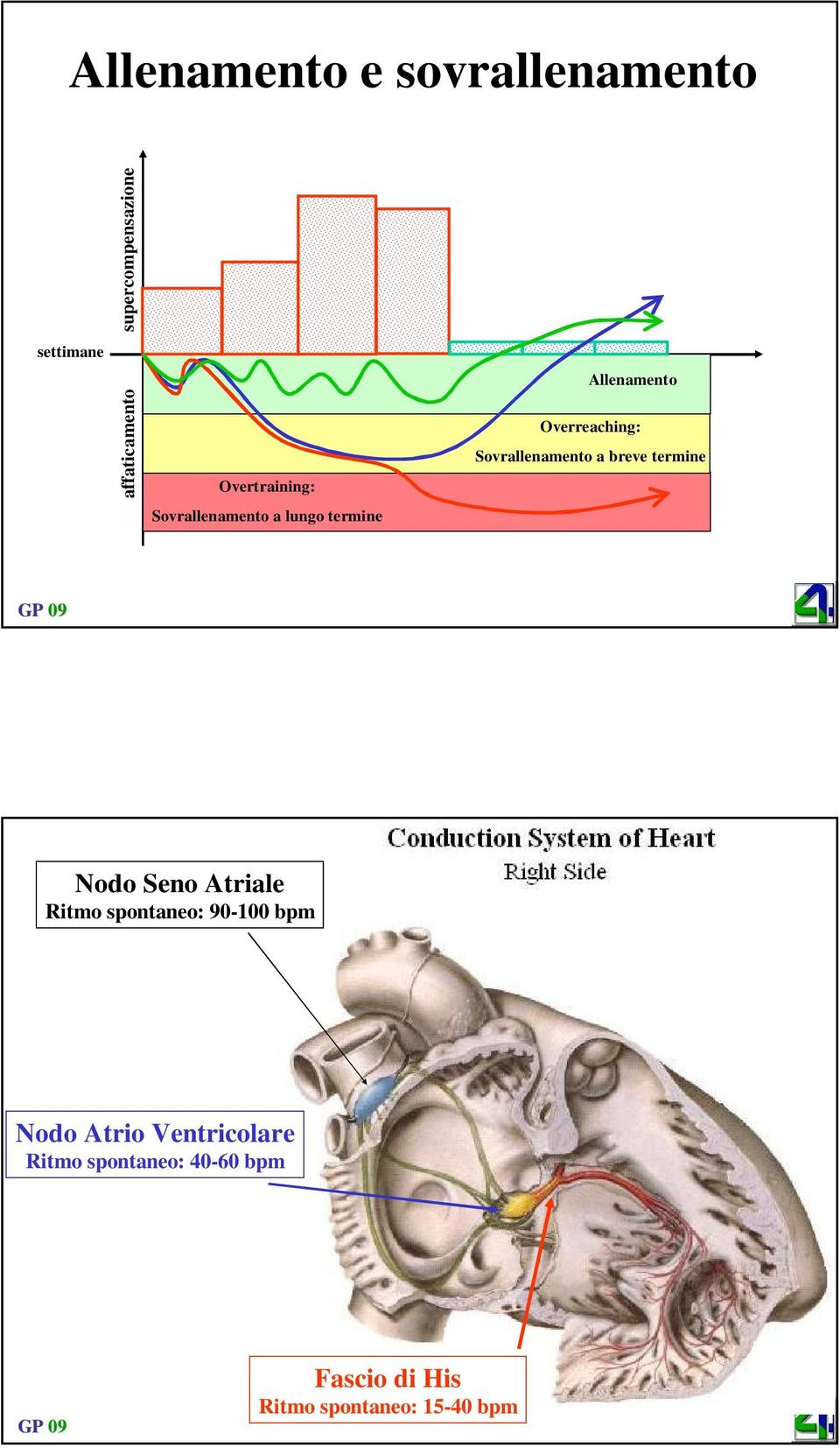 Sovrallenamento a lungo termine Nodo Seno Atriale Ritmo spontaneo: 90-100 bpm