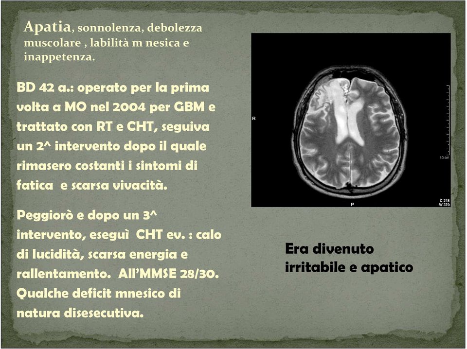 quale rimasero costanti i sintomi di fatica e scarsa vivacità. Peggiorò e dopo un 3^ intervento, eseguì CHT ev.