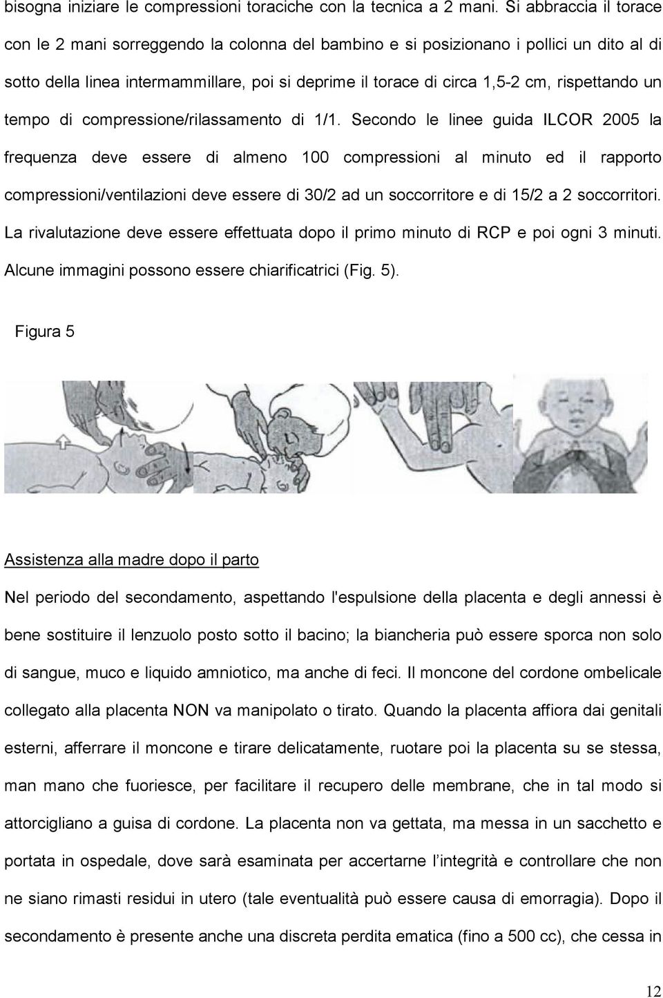 rispettando un tempo di compressione/rilassamento di 1/1.