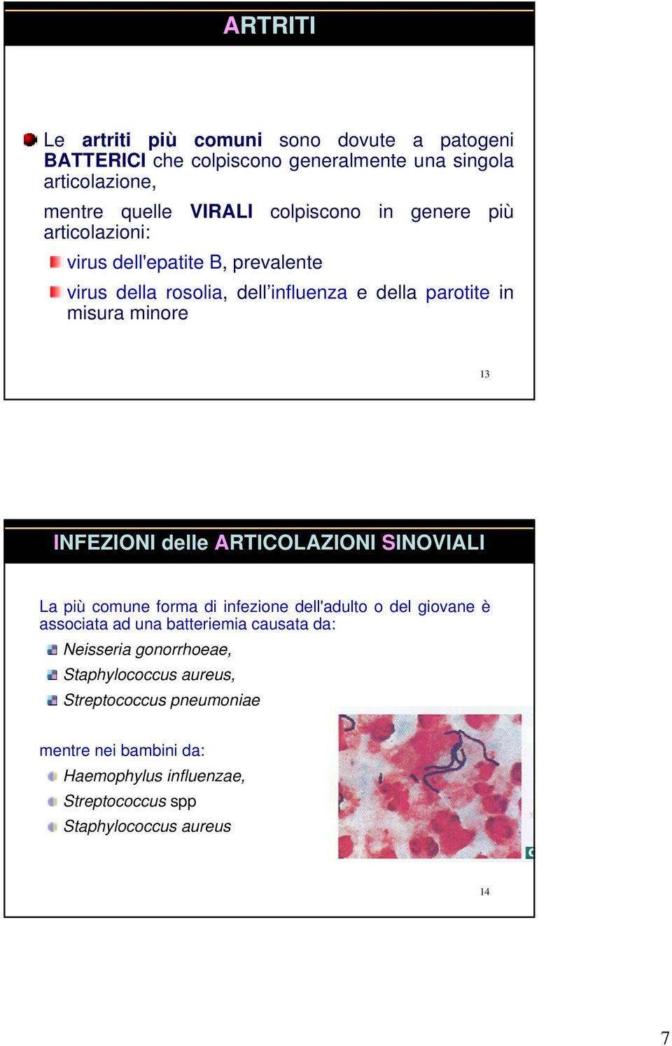 INFEZIONI delle ARTICOLAZIONI SINOVIALI La più comune forma di infezione dell'adulto o del giovane è associata ad una batteriemia causata da: