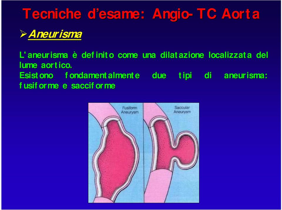 localizzata del lume aortico.