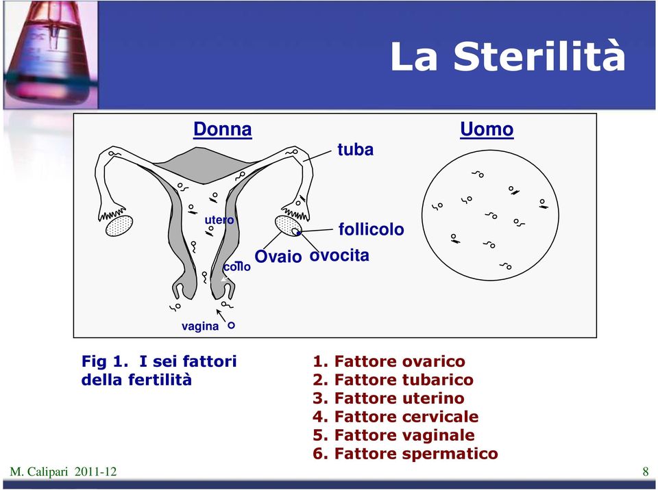 Fattore ovarico 2. Fattore tubarico 3. Fattore uterino 4.