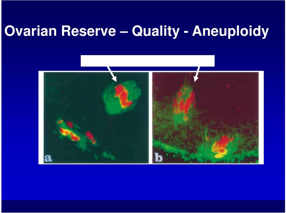 Aneuploidy