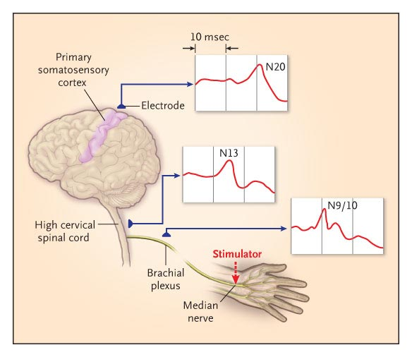 Problemi di cura instabile - VM - neurologico incerto Indagini diagnostiche TAC e