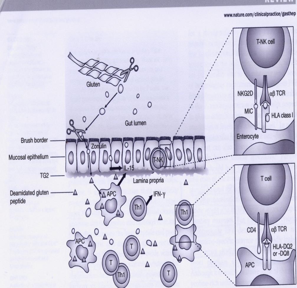 Glutine Aggregato proteico Gliadine e glutenine nel grano Prolamine : ordeine dell orzo, secaline della segale La gliadina non è completamente digeribile dai succhi