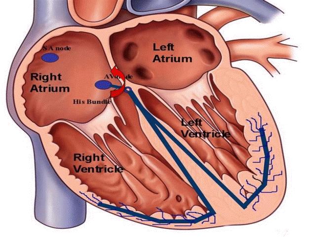 TRNAV Forme più comuni di aritmie parossistiche sopraventricolari (2/3 di tutte le TPSV) Meccanismo elettrogenetico rientro anatomico Più frequenti nelle donne (60 % dei casi), ed in qualsiasi età