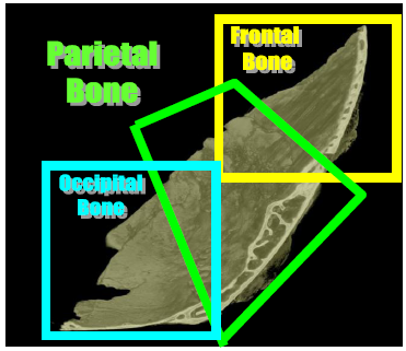 Figura 4.2 Slices della vertebra lombare. I volumi di campionamento trabecolari sono stati scelti, per tutte le spine lombari, nel corpo vertebrale del VII anello lombare [71].