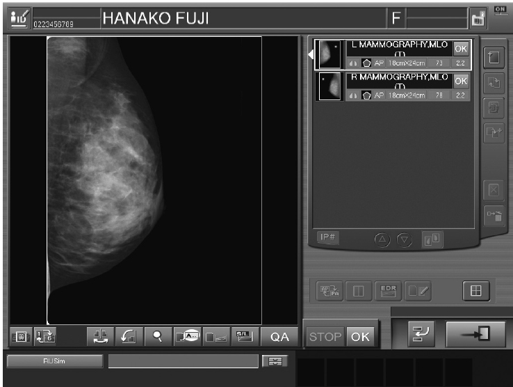 Aspetti fisici di un Lettore CR a doppia lettura: Image-Processing In radiologia prima dell anno 2004 Il film analogico Aspetti fisici di un