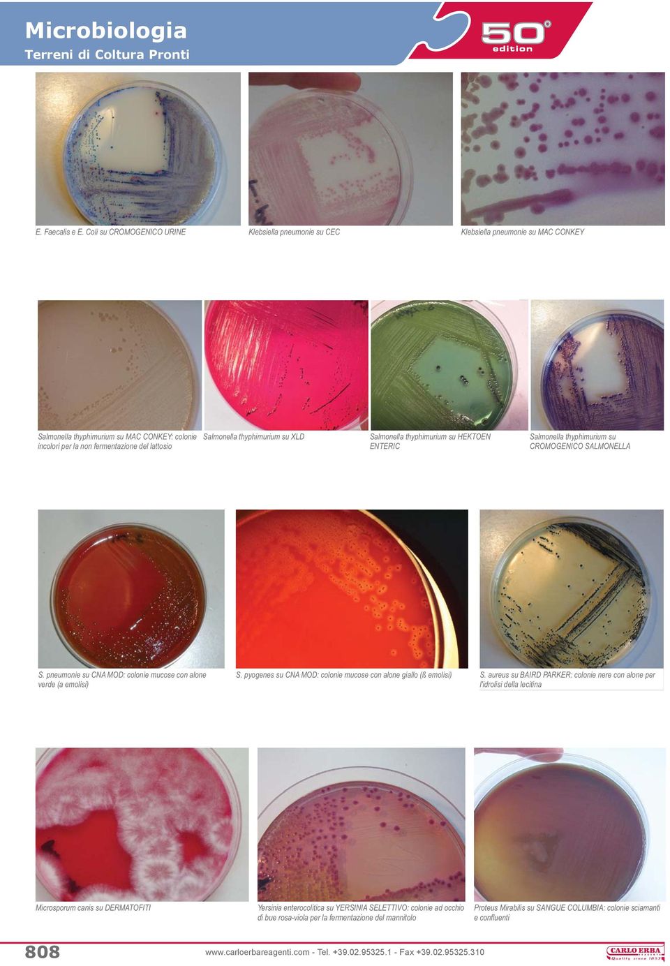 thyphimurium su XLD Salmonella thyphimurium su HEKTOEN ENTERIC Salmonella thyphimurium su CROMOGENICO SALMONELLA S. pneumonie su CNA MOD: colonie mucose con alone verde (a emolisi) S.