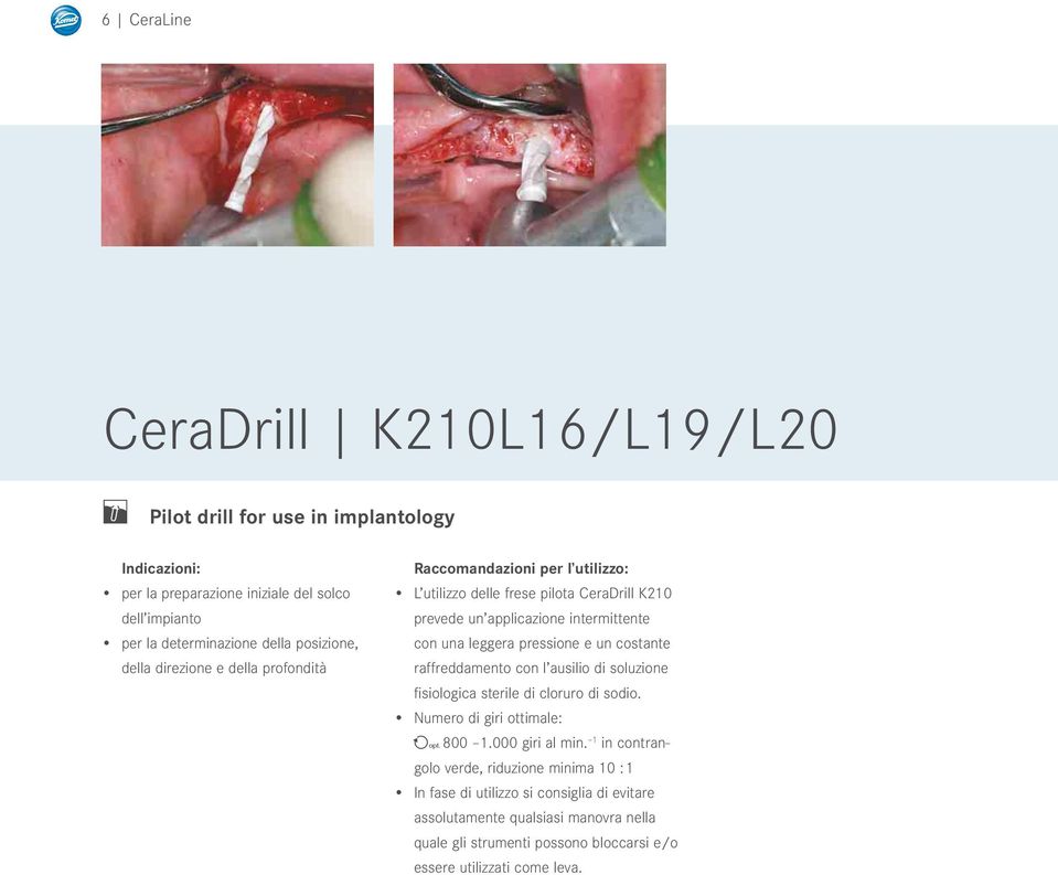 raffreddamento con l ausilio di soluzione fisiologica sterile di cloruro di sodio. (800 1.000 giri al min.