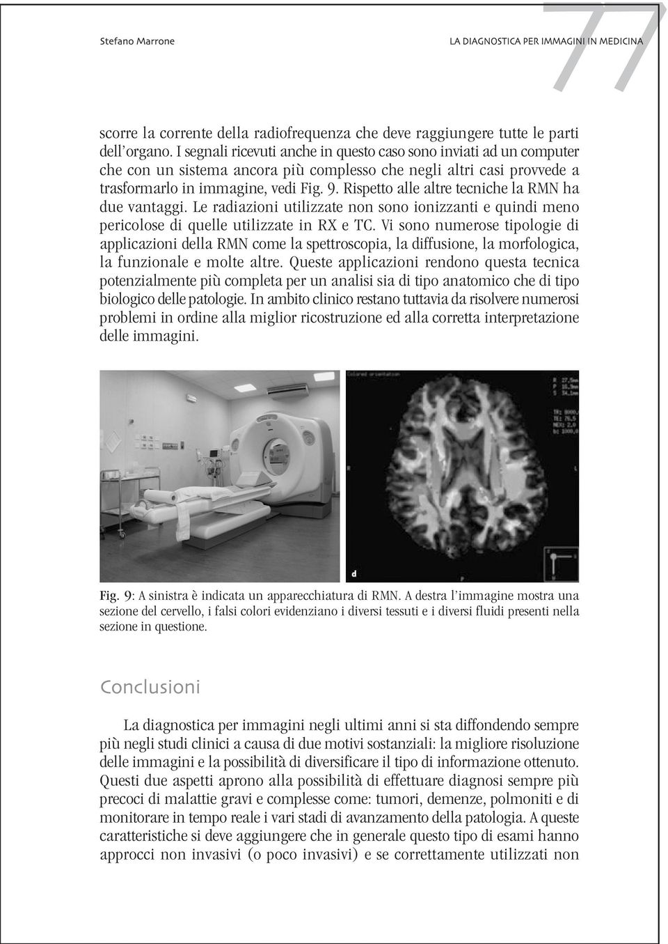 Rispetto alle altre tecniche la RMN ha due vantaggi. Le radiazioni utilizzate non sono ionizzanti e quindi meno pericolose di quelle utilizzate in RX e TC.