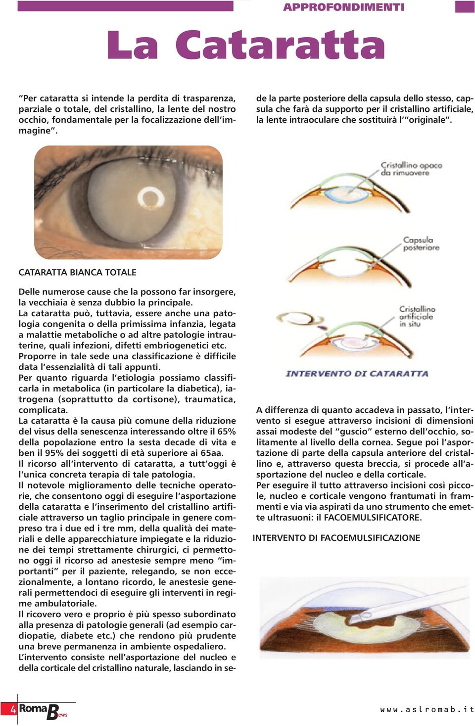 La cataratta può, tuttavia, essere anche una patologia congenita o della primissima infanzia, legata a malattie metaboliche o ad altre patologie intrauterine, quali infezioni, difetti embriogenetici