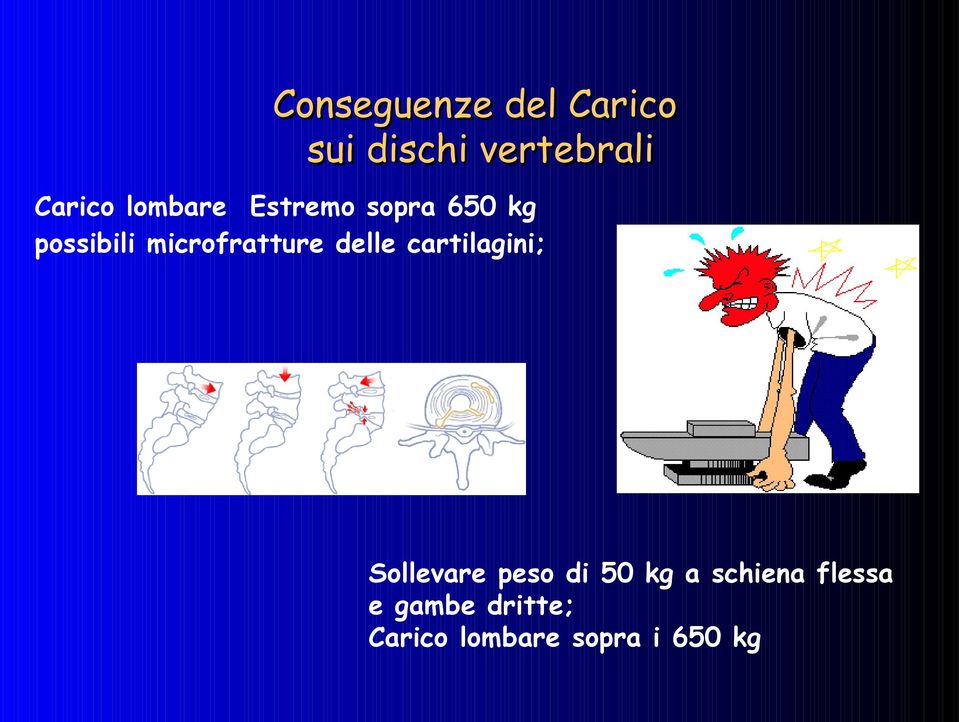 delle cartilagini; Sollevare peso di 50 kg a schiena