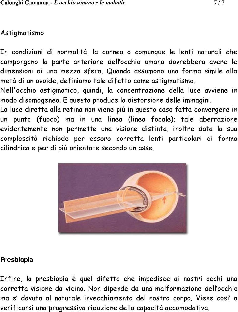 Nell'occhio astigmatico, quindi, la concentrazione della luce avviene in modo disomogeneo. E questo produce la distorsione delle immagini.