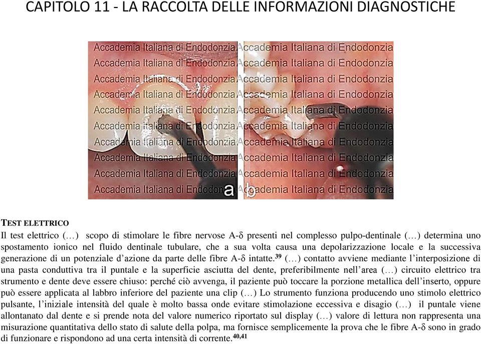 39 ( ) contatto avviene mediante l interposizione di una pasta conduttiva tra il puntale e la superficie asciutta del dente, preferibilmente nell area ( ) circuito elettrico tra strumento e dente