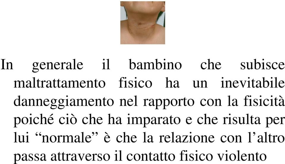 ciò che ha imparato e che risulta per lui normale è che la