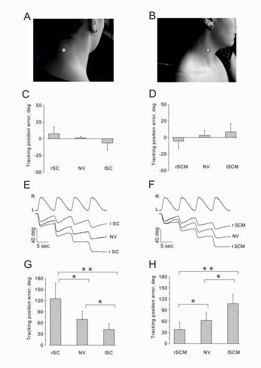 La vibrazione dei muscoli del collo