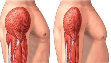 Cosa è la Sarcopenia?