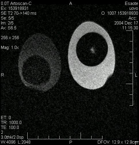 PRINCIPIO FISICO PER OTTENERE IMMAGINI MRI 1 - assegnare ad ogni punto dello spazio una diversa e nota frequenza di risonanza; 2 - l ampiezza del segnale a quella data frequenza (ottenuta mediante