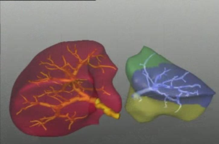 Per esempio la struttura geometrica della vena porta