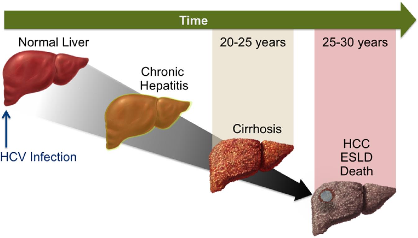 Un quadro coerente Storia naturale dell infezione da HCV I