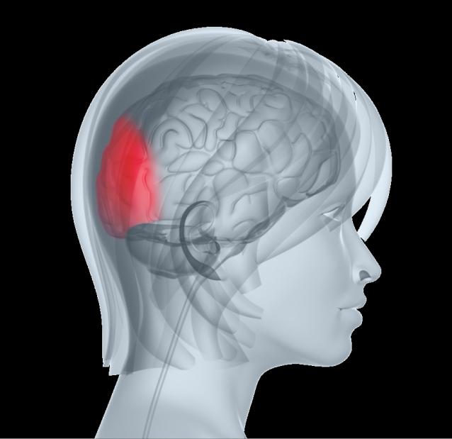 alterata dell attività cerebrale 2 Attivazione del midollo allungato CSD = Depressione Corticale