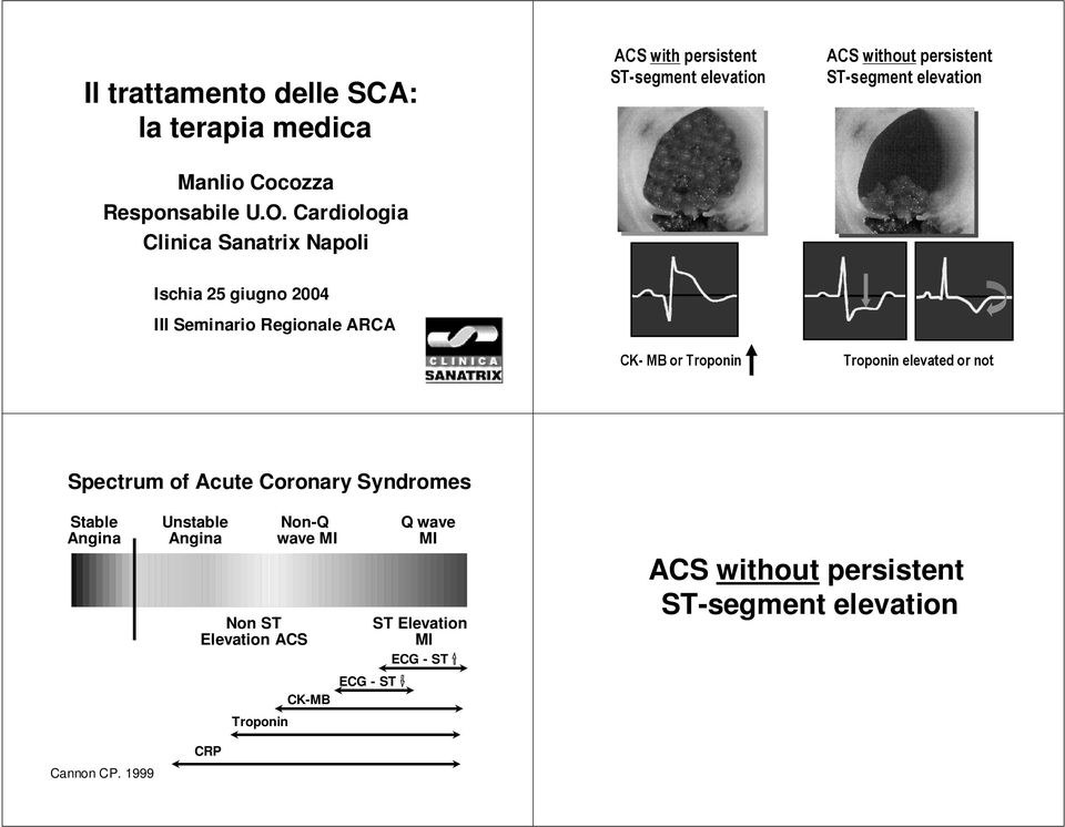 Acute Coronary Syndromes Stable Angina Cannon CP.