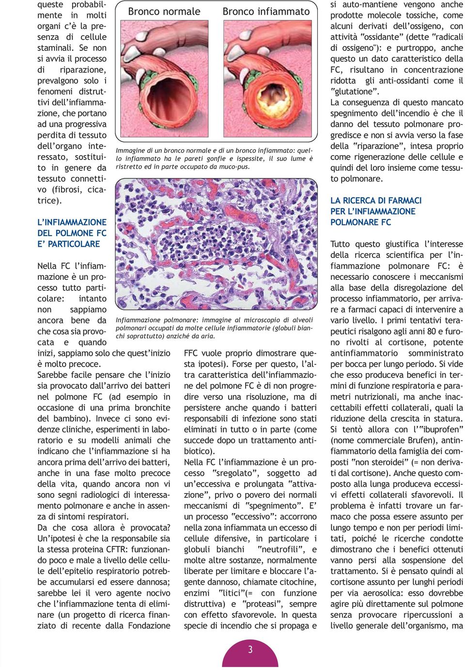 da tessuto connettivo (fibrosi, cicatrice).