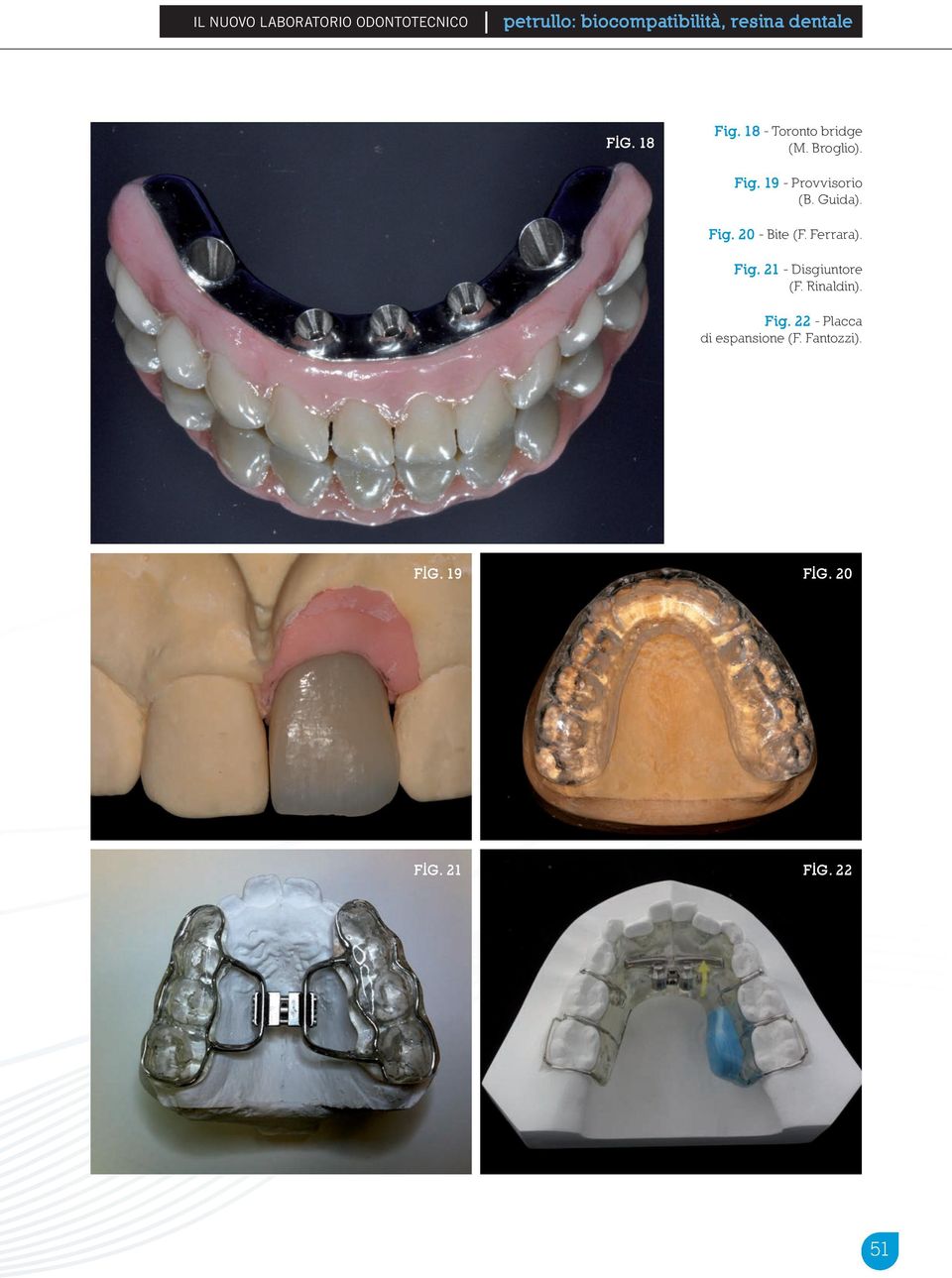 Broglio). Fig. 19 - Provvisorio (B. Guida). Fig. 20 - Bite (F. Ferrara). Fig. 21 - Disgiuntore (F.