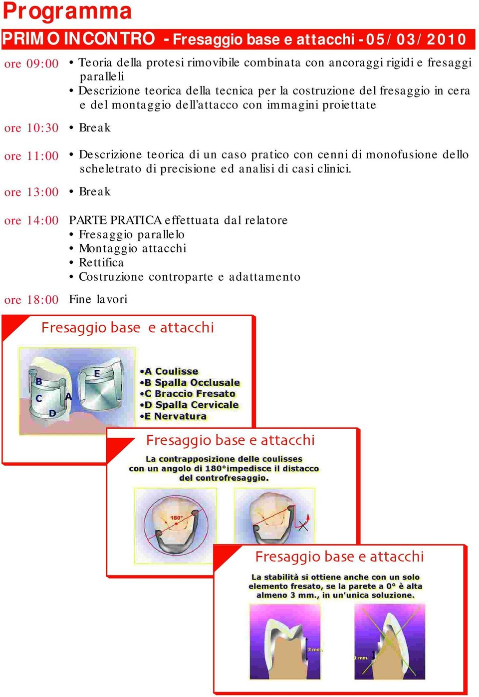 18:00 Descrizione teorica di un caso pratico con cenni di monofusione dello scheletrato di precisione ed analisi di casi clinici.