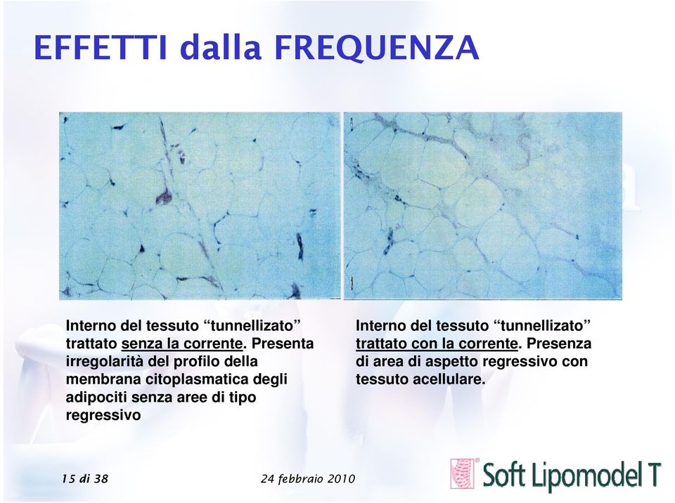 Presenta irregolarità del profilo della membrana citoplasmatica degli adipociti