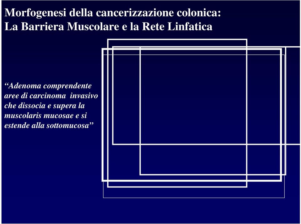 comprendente aree di carcinoma invasivo che