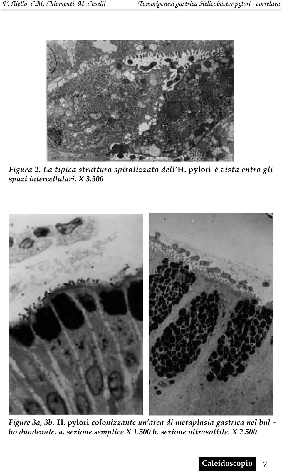 500 Figure 3a, 3b. H.