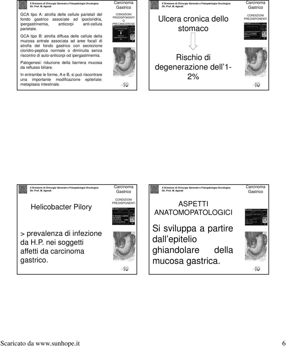 auto-anticorpi od ipergastrinemia. Patogenesi: riduzione della barriera mucosa da reflusso biliare.